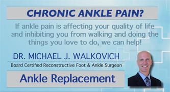 inbone total ankle ad clear